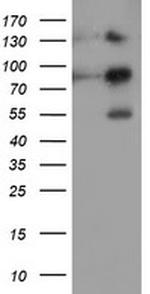 FOLH1 Antibody in Western Blot (WB)