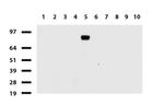 FOLH1 Antibody in Western Blot (WB)