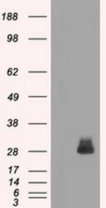 FOSL1 Antibody in Western Blot (WB)