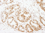 FOXK1 Antibody in Immunohistochemistry (IHC)