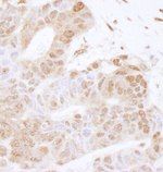 FOXK2 Antibody in Immunohistochemistry (IHC)