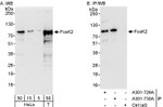 FOXK2 Antibody in Western Blot (WB)