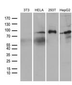 FOXO1 Antibody in Western Blot (WB)