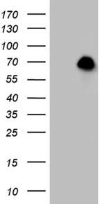 FOXO1 Antibody in Western Blot (WB)