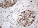 FOXO4 Antibody in Immunohistochemistry (Paraffin) (IHC (P))