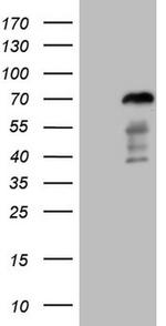 FOXO4 Antibody in Western Blot (WB)