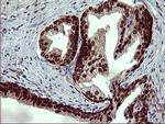 FOXP1 Antibody in Immunohistochemistry (Paraffin) (IHC (P))