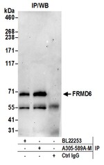 FRMD6 Antibody in Western Blot (WB)