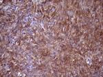 FSCN1 Antibody in Immunohistochemistry (Paraffin) (IHC (P))