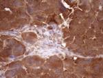 FSCN1 Antibody in Immunohistochemistry (Paraffin) (IHC (P))