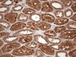 FSCN1 Antibody in Immunohistochemistry (Paraffin) (IHC (P))