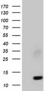 FSHB Antibody in Western Blot (WB)