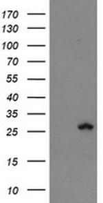 FXN Antibody in Western Blot (WB)