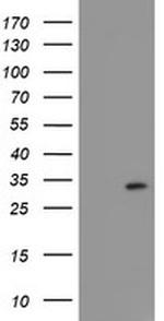 FXN Antibody in Western Blot (WB)