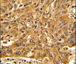 Fascin Antibody in Immunohistochemistry (IHC)