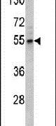 Fascin Antibody in Western Blot (WB)