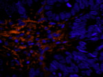 Filamin A Antibody in Immunohistochemistry (IHC)