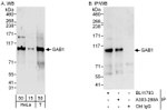 GAB1 Antibody in Western Blot (WB)