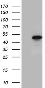 GABPB1 Antibody in Western Blot (WB)