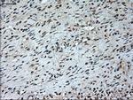 GAD1 Antibody in Immunohistochemistry (Paraffin) (IHC (P))