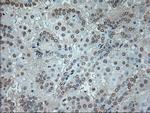 GAD1 Antibody in Immunohistochemistry (Paraffin) (IHC (P))