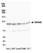 GANAB/Glucosidase II Subunit alpha Antibody in Western Blot (WB)