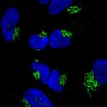 Rabbit IgG (H+L) Highly Cross-Adsorbed Secondary Antibody in Immunocytochemistry (ICC/IF)