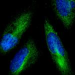 Rabbit IgG (H+L) Highly Cross-Adsorbed Secondary Antibody in Immunocytochemistry (ICC/IF)