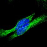 Rabbit IgG (H+L) Highly Cross-Adsorbed Secondary Antibody in Immunocytochemistry (ICC/IF)