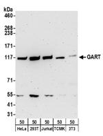 GART Antibody in Western Blot (WB)