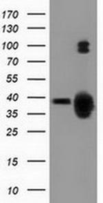 GAS7 Antibody in Western Blot (WB)