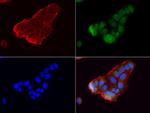 GBA Antibody in Immunocytochemistry (ICC/IF)