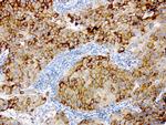 GBA Antibody in Immunohistochemistry (Paraffin) (IHC (P))