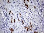 GBA Antibody in Immunohistochemistry (Paraffin) (IHC (P))