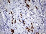 GBA Antibody in Immunohistochemistry (Paraffin) (IHC (P))