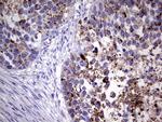 GBA Antibody in Immunohistochemistry (Paraffin) (IHC (P))