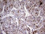 GBA Antibody in Immunohistochemistry (Paraffin) (IHC (P))