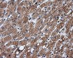 GBE1 Antibody in Immunohistochemistry (Paraffin) (IHC (P))