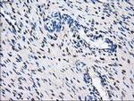 GBE1 Antibody in Immunohistochemistry (Paraffin) (IHC (P))