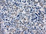 GBE1 Antibody in Immunohistochemistry (Paraffin) (IHC (P))