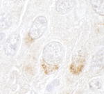 GBF1 Antibody in Immunohistochemistry (IHC)