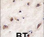 GDF1 Antibody in Immunohistochemistry (IHC)