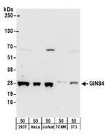 GINS4 Antibody in Western Blot (WB)