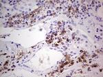 GLI1 Antibody in Immunohistochemistry (Paraffin) (IHC (P))