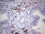 GLI1 Antibody in Immunohistochemistry (Paraffin) (IHC (P))