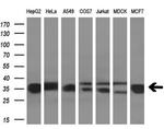 GNMT Antibody in Western Blot (WB)