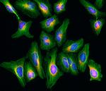 Rat IgG (H+L) Highly Cross-Adsorbed Secondary Antibody in Immunocytochemistry (ICC/IF)