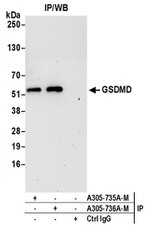 GSDMD Antibody in Immunoprecipitation (IP)