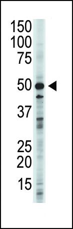 GSK3B Antibody in Western Blot (WB)