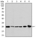 GSTM1 Antibody in Western Blot (WB)